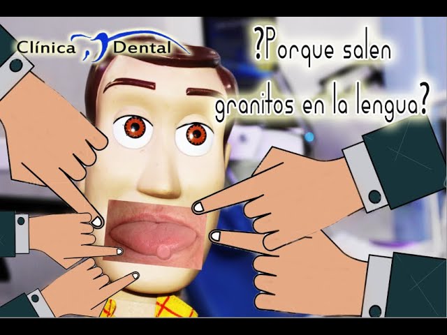 porque tengo bolitas en la lengua