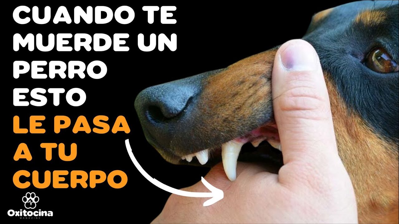 un perro me mordio la pierna